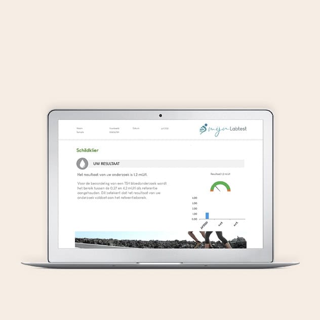 PCOS test uitgebreid